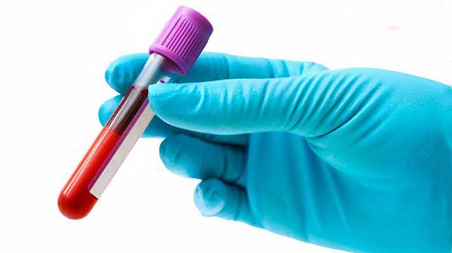 Desarrollan Una Prueba De Sangre Capaz De Detectar 8 Tipos De Cáncer